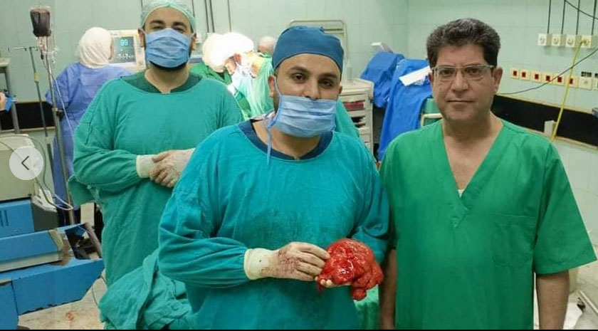 أطباء مشفى دمشق ينهون 14 عاماً من المعاناة.. حالة نادرة وثقتها مجلة محكمة عالمياً